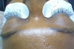 eye-lashes-treatment1